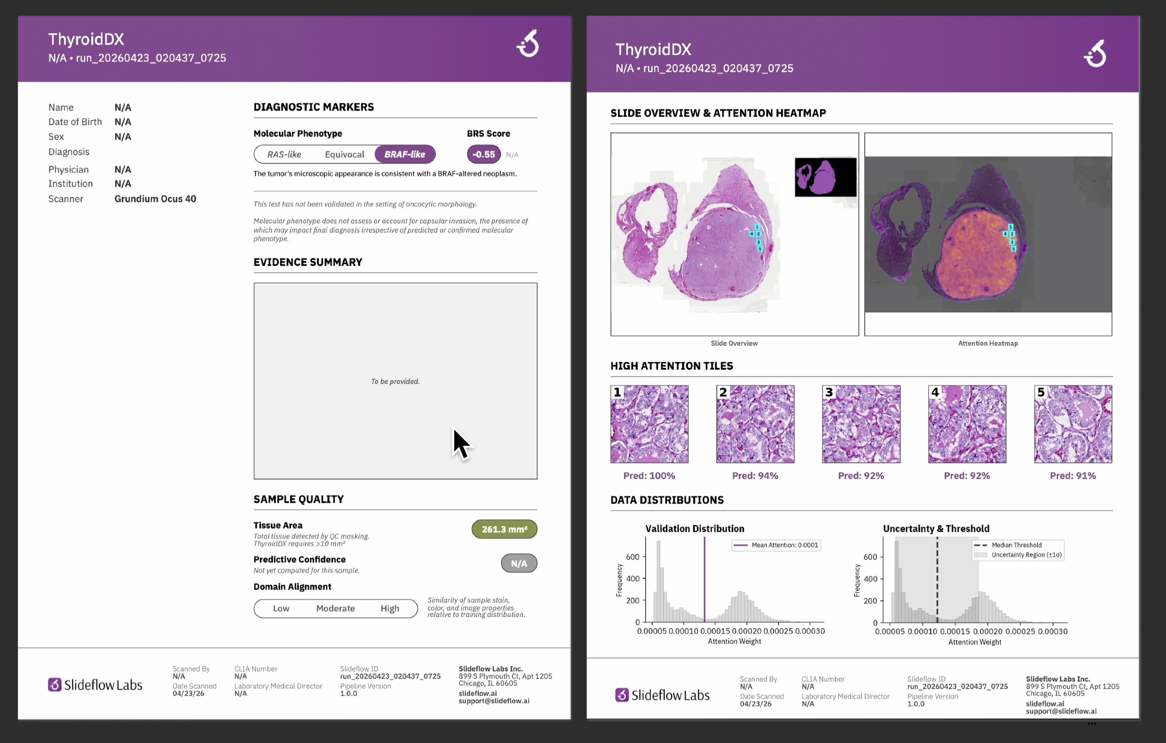 ThyroidDX prototype screens: diagnostic summary and slide overview with attention heatmap and data distributions
